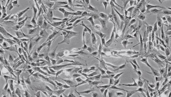 人淋巴内皮细胞的复苏与传代及冻存操作步骤！