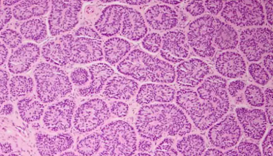 TCAM-2人睾丸精原瘤细胞的培养步骤与操作方法！