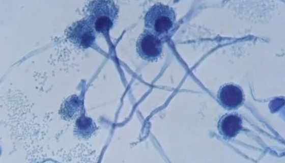 ATCC 18943 解脂复膜孢酵母（亚罗解脂酵母）