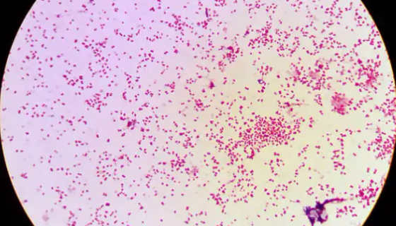 淋病奈瑟氏球菌的知识简介及临床意义！