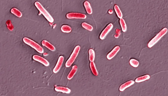 皱纹假单胞菌的使用范围与培养方法及实验内容！