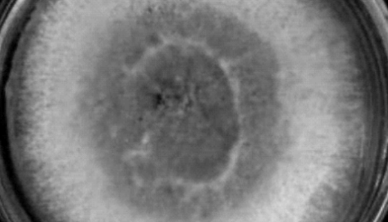 嗜热毁丝菌的菌株特点与形态特征及主要价值！