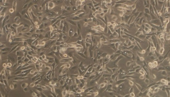 RWPE-1人正常前列腺上皮细胞的培养步骤与应用！