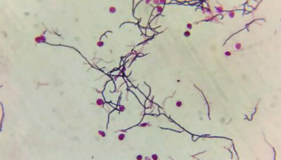 ATCC 12757小白链霉菌的特点与优势及培养方法！