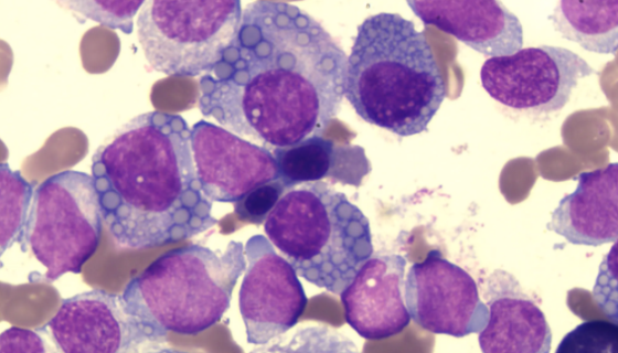 EBV-转化人淋巴细胞的培养与处理及注意事项！