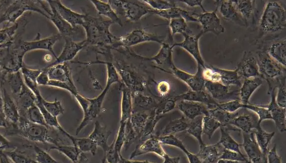 大鼠脑动脉血管内皮细胞的分离方法与质量检测！