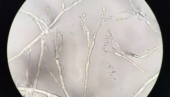 筑波拟酵母的特点与优势及培养与保存方法！