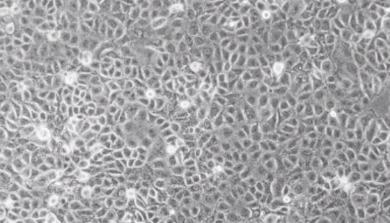 CFPAC-1人胰腺癌细胞的结构与特点及其功能！