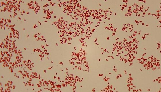 ATCC 21420 乳糖发酵短杆菌的培养及打管说明！