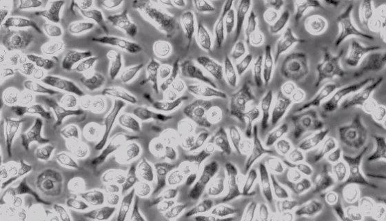 Ana-1（小鼠巨噬细胞）的使用与处理及注意事项！