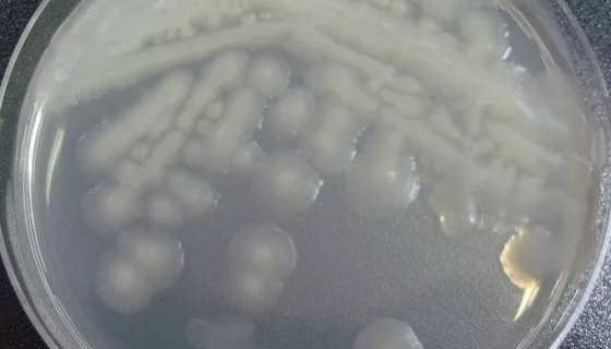 粪产碱菌粪亚种的培养方法与注意事项！