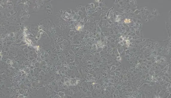 JAR人胎盘绒毛癌细胞的培养操作步骤及应用！