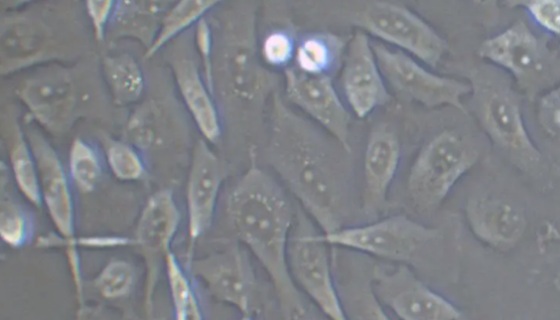 HFLS-RA 类风湿关节炎成纤维样滑膜细胞