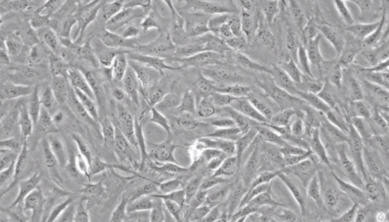 L-929 小鼠成纤维细胞的处理方法与培养步骤！