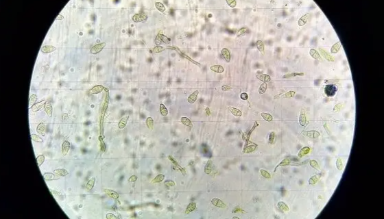 稻瘟病菌的病原特征与生理特性及防治方法！