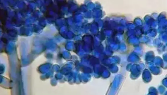 蓝色犁头霉的培养条件与注意事项及打管说明！