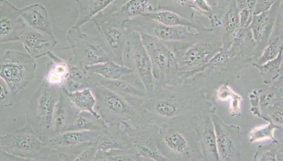 人髓母细胞瘤细胞的处理方法与培养步骤！