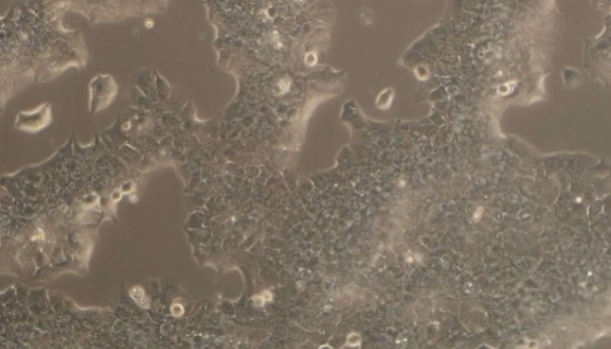 小鼠胚胎干细胞接受后的处理与培养方法！