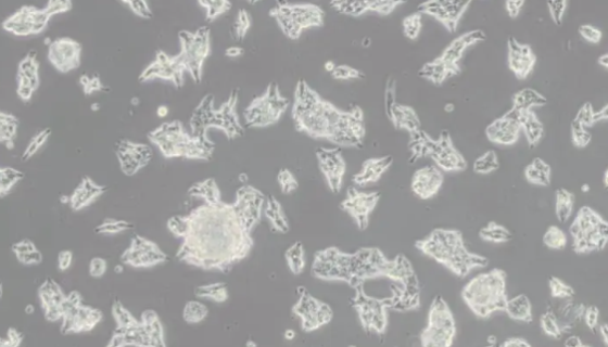 大鼠胰腺腺泡细胞的运输和保存及使用与处理！