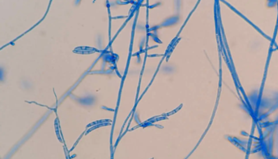 茄拉尔氏菌的形态特征与主要价值及培养方法！