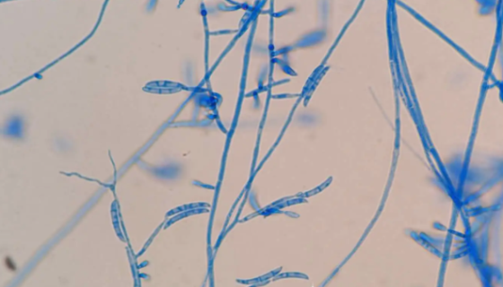 茄科罗尔斯通氏菌——用于烟叶青枯病生防研究