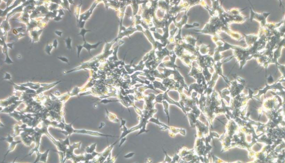 SK-N-SH人神经母细胞瘤细胞的培养步骤与应用！