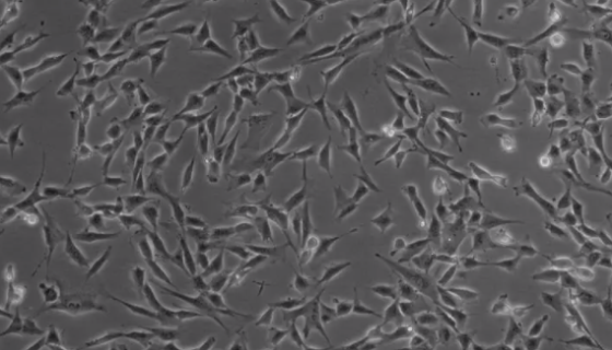 人肾成纤维细胞的生理功能及相关研究！