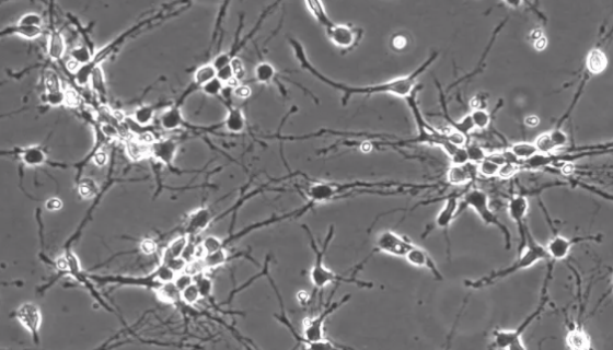 小鼠脑皮层神经元细胞的运输和保存及使用方法！