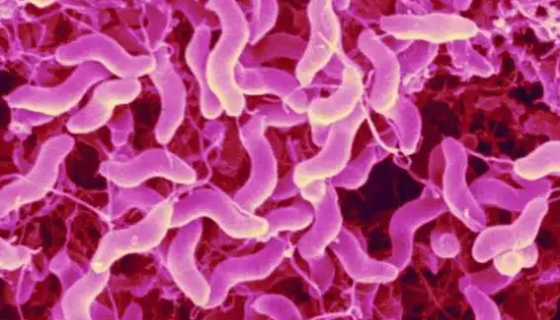 空肠弯曲菌的发病机制与临床表现及预防措施！