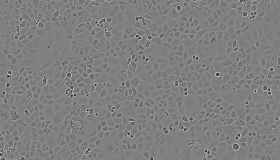 小鼠前列腺癌细胞的性质、用途与生产工艺！