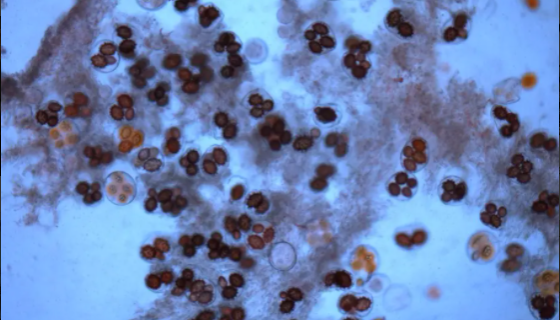 ATCC 43182 生盘纤发菌 百欧博伟生物