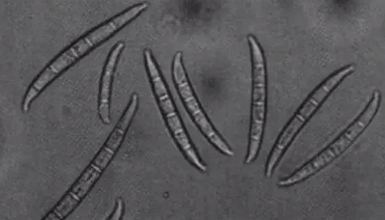 禾谷镰刀菌的形态特征与致病能力及侵染循环！