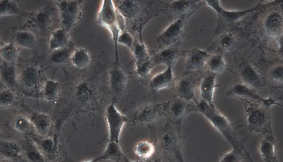 FHL124人晶状体上皮细胞的培养操作说明！