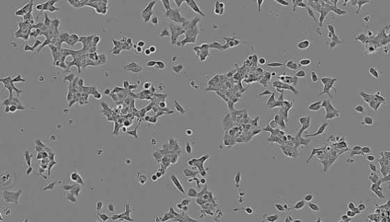 大鼠胰岛素瘤细胞收到后的处理方法与培养步骤！