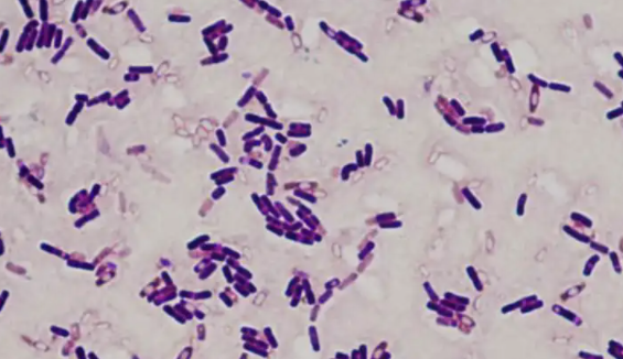 胶质芽孢杆菌的使用方法与打管说明及注意事项！