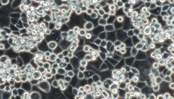 U-87MG/U87MG 人脑星形胶质母细胞瘤细胞