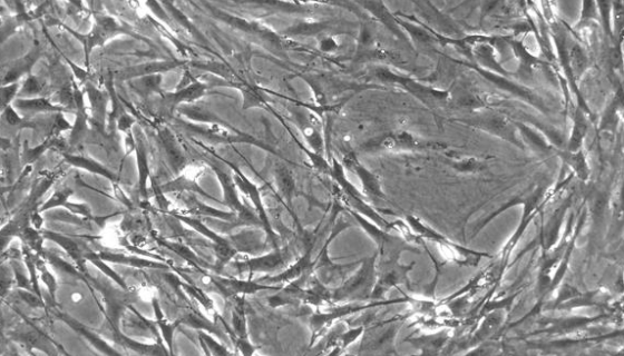 小鼠子宫内膜间质细胞的运输和保存及处理方法！