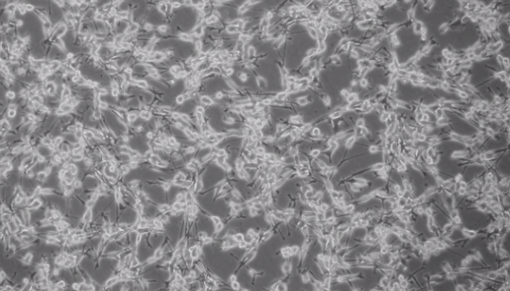 CMT93小鼠结肠癌细胞的处理方法与培养步骤！