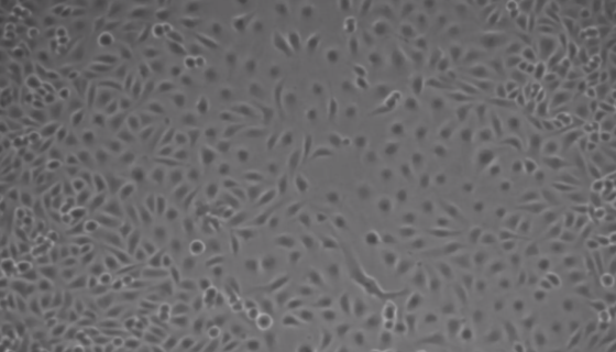 人冠状动脉内皮细胞的培养步骤与应用！