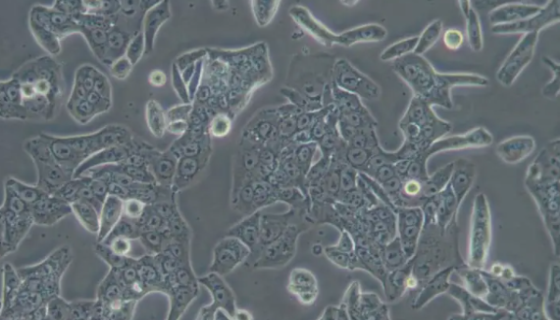 HT115 人结肠癌细胞的处理方法与培养步骤！