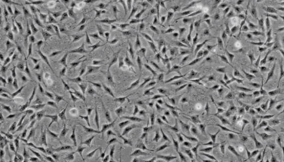 HCEC人角膜上皮细胞的主要功能及验收注意事项！