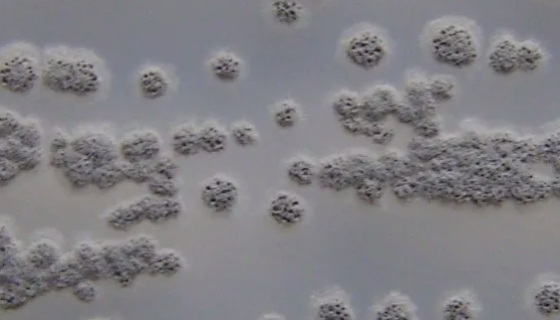 阿氟曼链霉菌的培养条件与操作方法及注意事项！