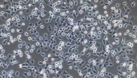 HCC515 人肺腺癌细胞的处理方法与培养步骤！