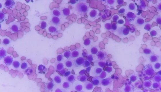 HMC-1人肥大细胞的培养条件与操作步骤！