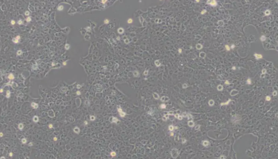SCC-4人舌鳞癌细胞的处理方法及培养操作规程！