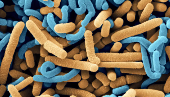 耐酸乳杆菌的培养条件与注意事项及保存方法！