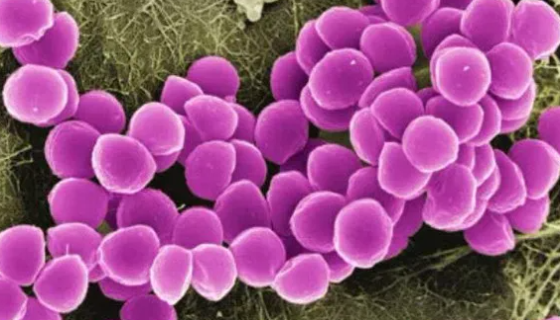 小牛肉葡萄球菌冷冻干燥保藏转接技术与方法！