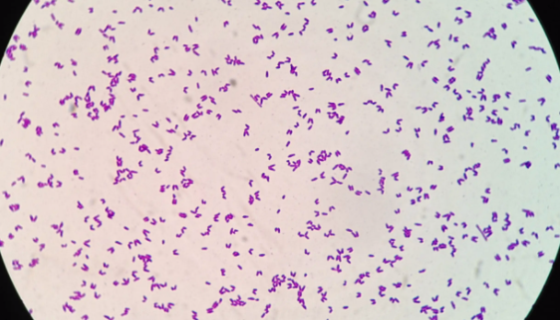 类谷糠乳杆菌的主要价值与培养条件及注意事项！