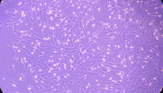 人骨髓血间充质干细胞的处理方法与培养步骤！