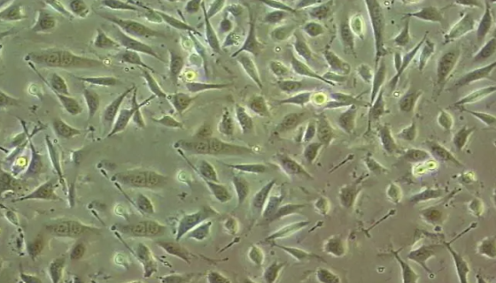 人绒毛膜肿瘤细胞的培养步骤与处理方法！